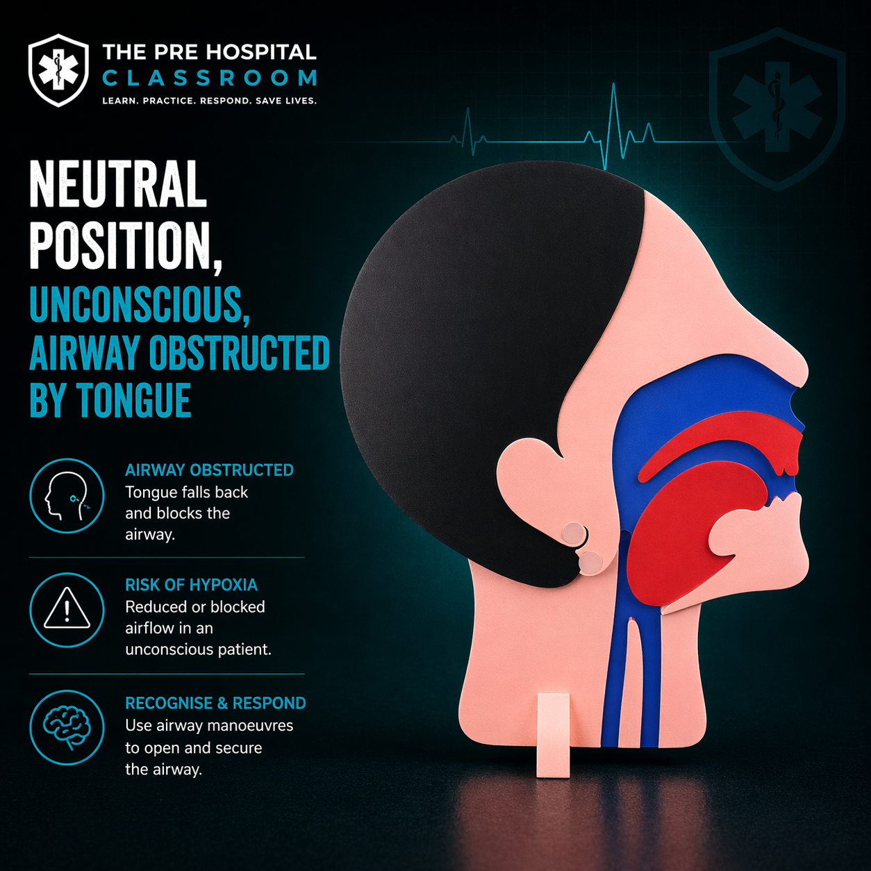 Jaw Thrust Airway Training Device - 3